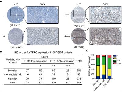 Overexpressed transferrin receptor implied poor prognosis and relapse in gastrointestinal stromal tumors